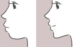 口元のイラスト