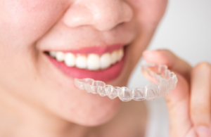 マウスピース矯正