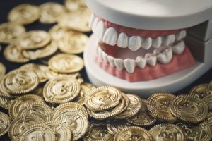歯列模型とお金